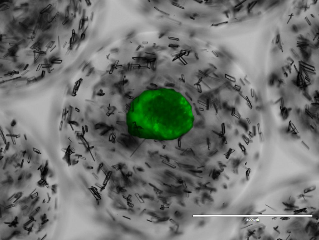 Image of co-encapsulation of crystal drug depots & stained viable islets