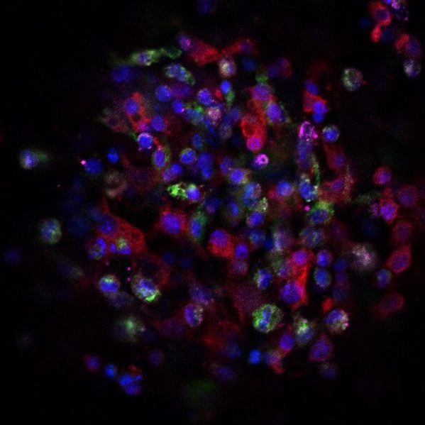 Complex-multi-cellular-signaling-in-biomaterial-response