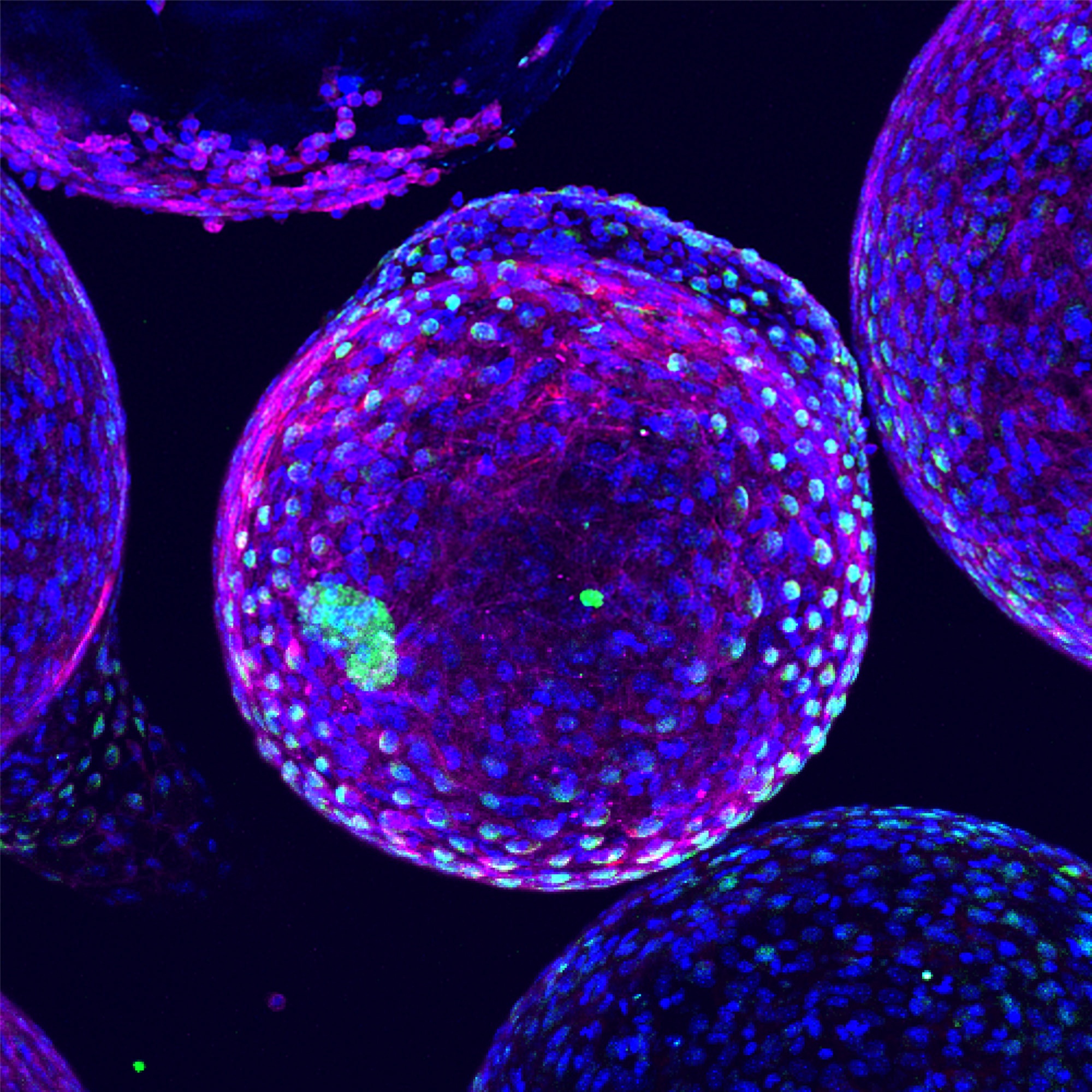 Complexe biomaterial response to cell encapsulation system with islets inside - blue DAPI, green Macrophages, Red alpha smooth muscle actin (inside green islet clusters)