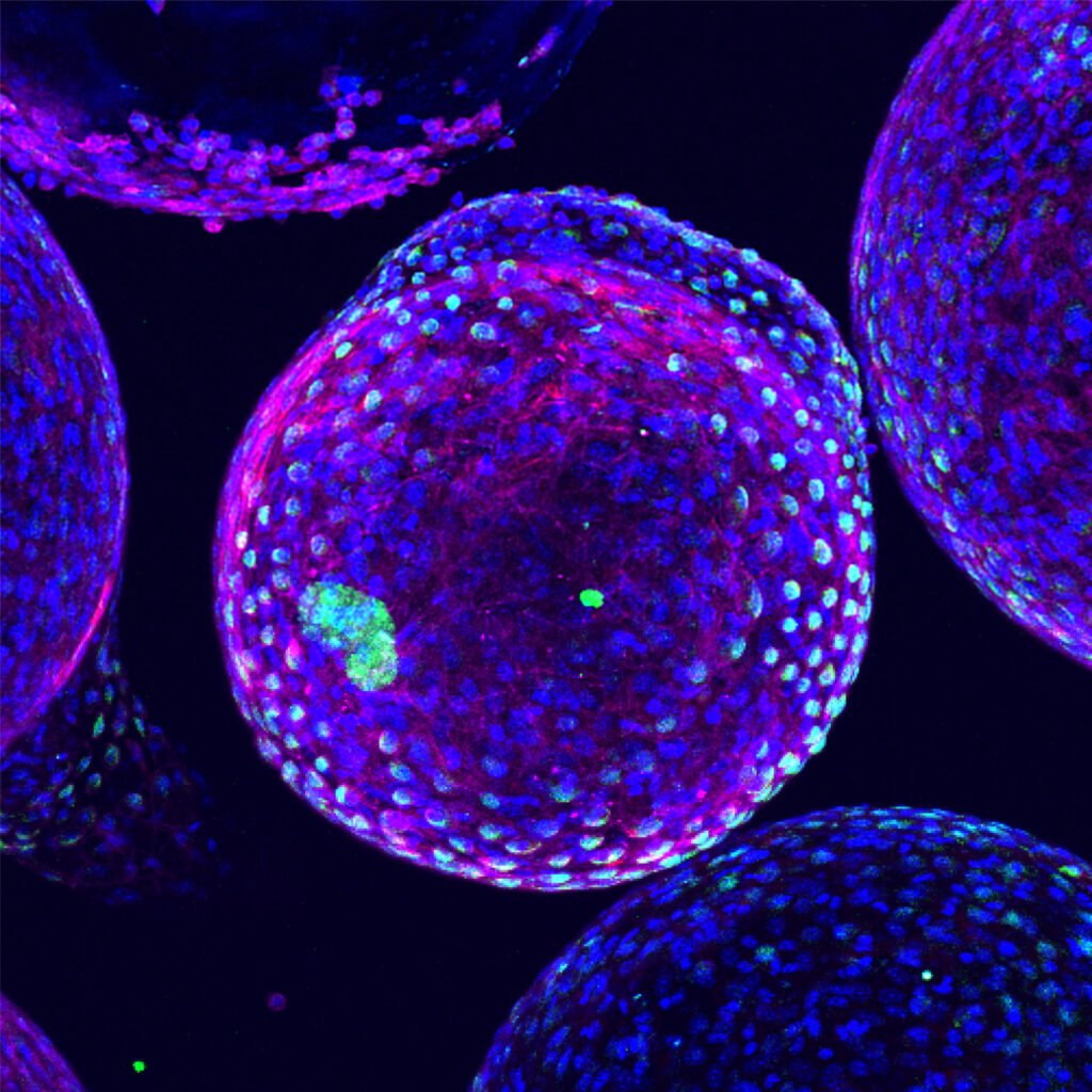 Complex biomaterial response to cell encapsulation system with islets inside - blue DAPI, green Macrophages, Red alpha smooth muscle actin (inside green islet clusters)