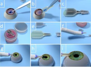 A series of images show how the device works.