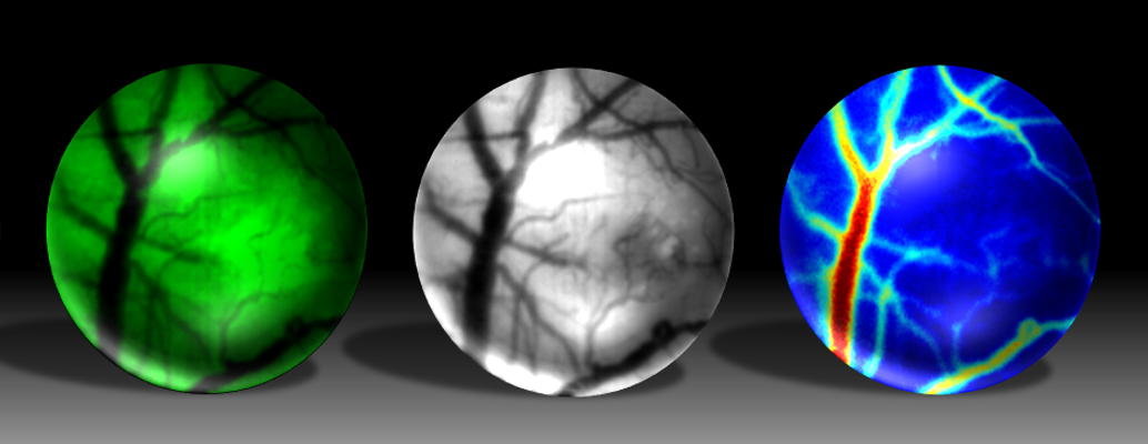 Three different images of the brain are showed from the mini microscope.