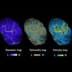 maps of tumors grown in mice.