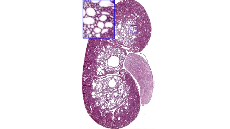 A kidney slice is shown from a microscope.