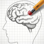 The image shows a sketch of a human head and brain.