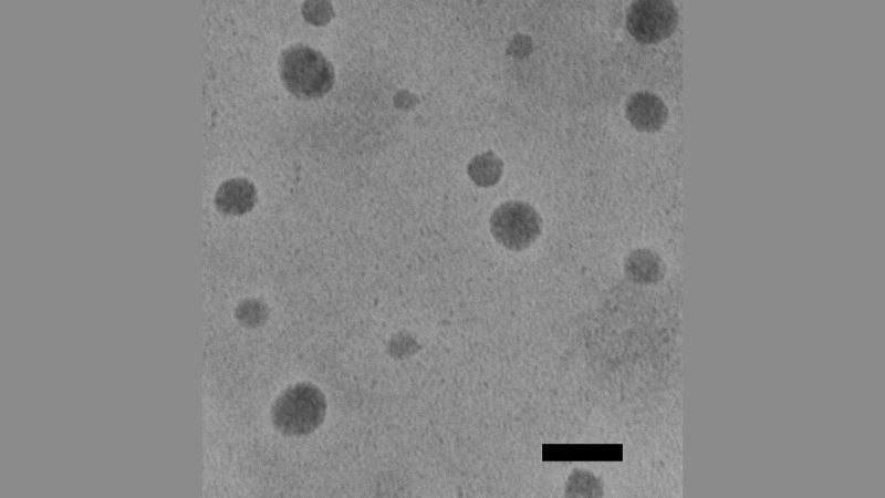 A microscopic image of the nanoparticles used in the study.