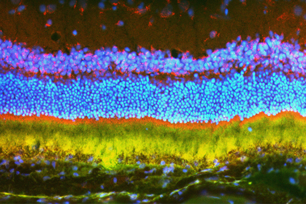 Nanoparticles