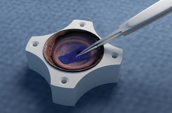 A device used for corneal transplants.