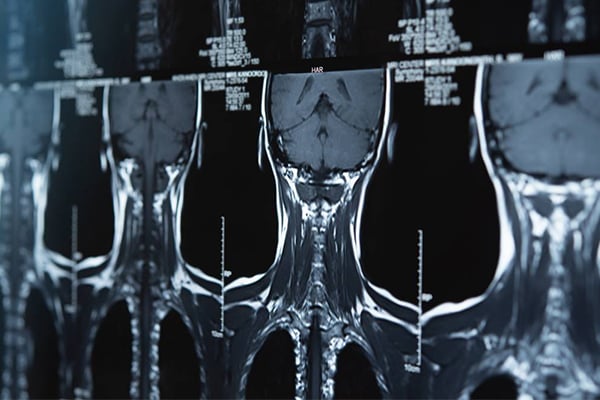 An x-ray of a head and spinal cord are shown.