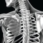 The image shows a computer rendering of a back x-ray.