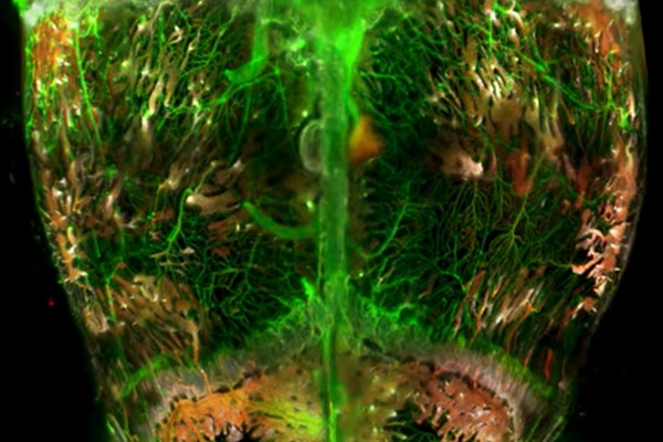 3D map of blood vessels and stem cells in a mouse skull. Credit: Alexandra Rindone, Warren Grayson, Johns Hopkins Medicine