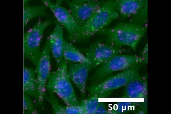 Microscope image of the cells used to test nanoparticles.