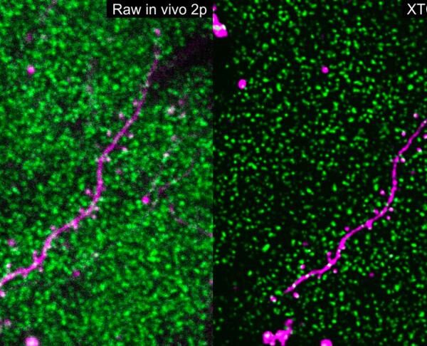 In side by side images, magentas lines weave through an array of fluorescent green dots; the image on the right has greater detail.
