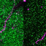 In side by side images, magentas lines weave through an array of fluorescent green dots; the image on the right has greater detail.