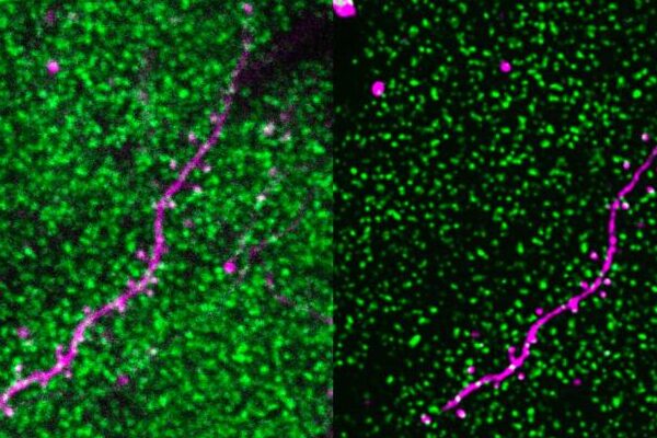 In side by side images, magentas lines weave through an array of fluorescent green dots; the image on the right has greater detail.