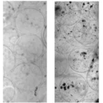 Microscopic image of biomaterial fibrosis