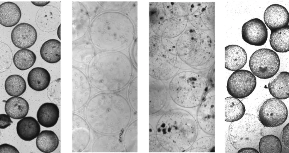 Microscopic image of biomaterial fibrosis