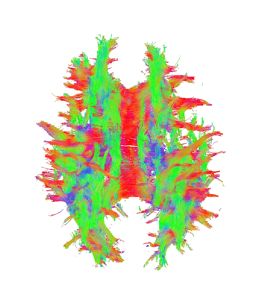 3D model of DeepSTI brain reconstruction
