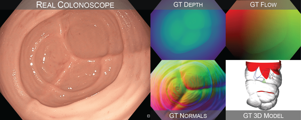 Sample frame from the C3VD dataset