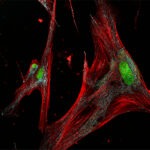 Fibroblast