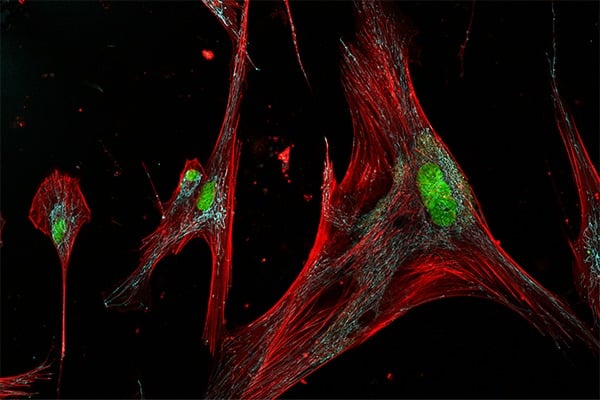Fibroblast