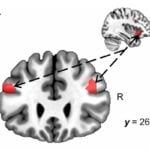 This functional MRI image of a human brain illustrates the connection between the insula (smaller brain image) and the dorsal lateral prefrontal cortex (larger brain image) as a result of cognitive fatigue.